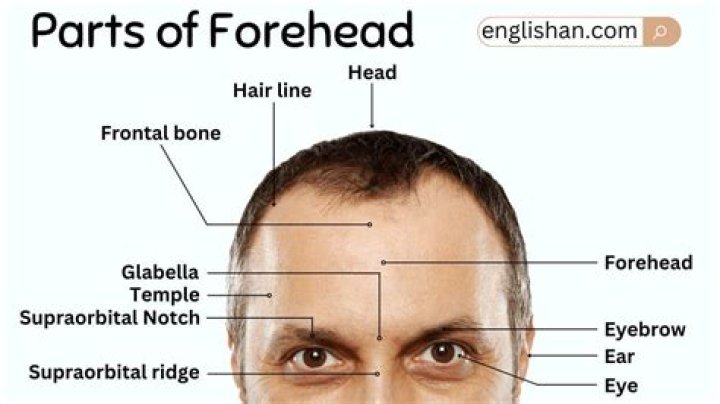 Unveiling The Humor Behind Forehead Jokes: Insights And Hidden Gems